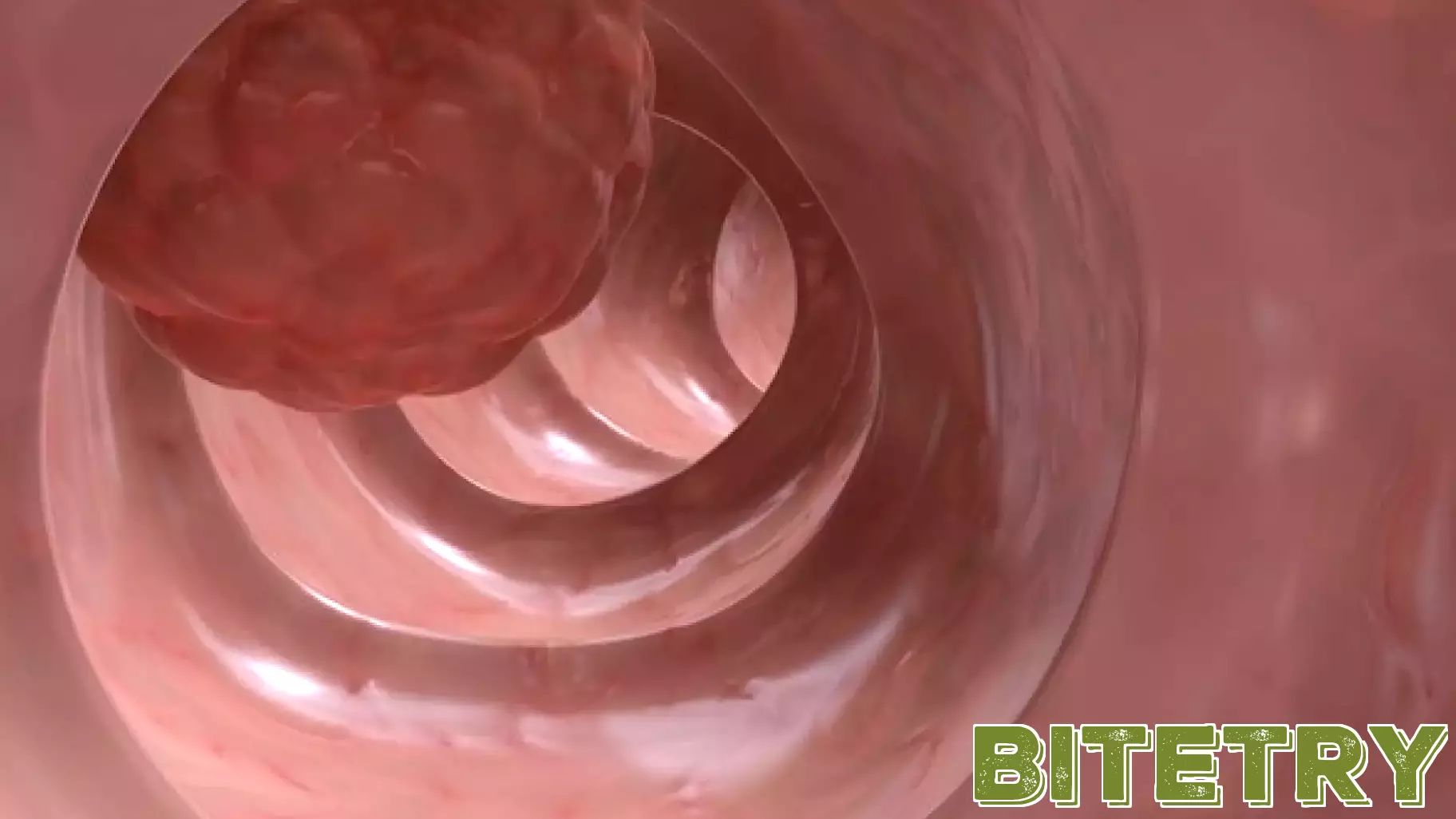 AGA Releases Updated Guidelines on AI in Colonoscopy