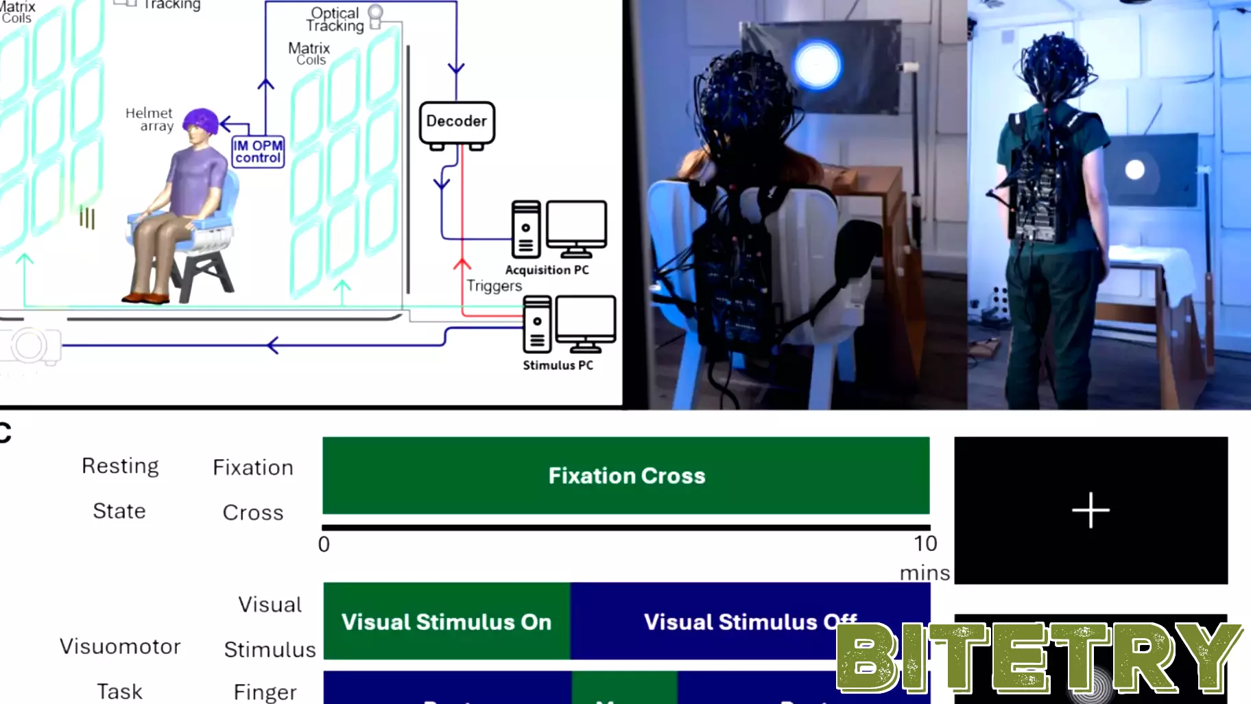 Innovative Wearable Technology Enhances Understanding of Multiple Sclerosis